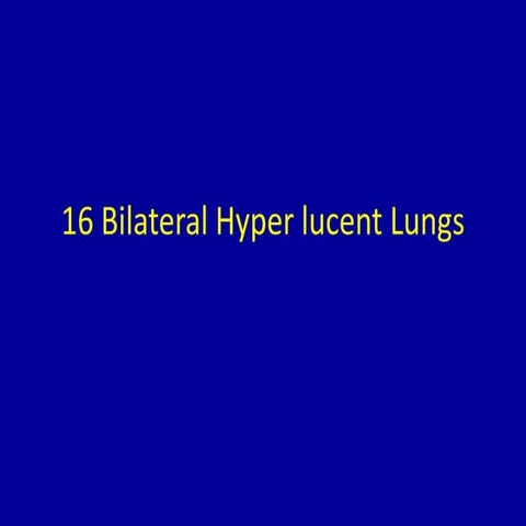 16 bilateral hyper lucent lungs | PPTX