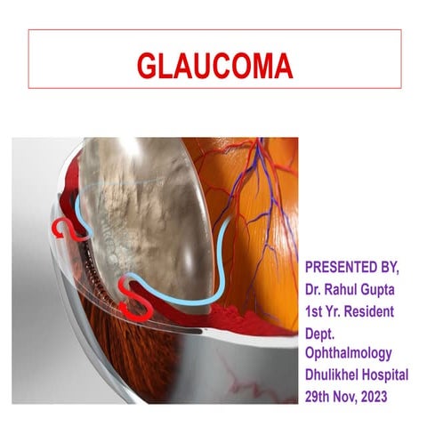 17.02 introduction to glaucoma  and POAG.pptx