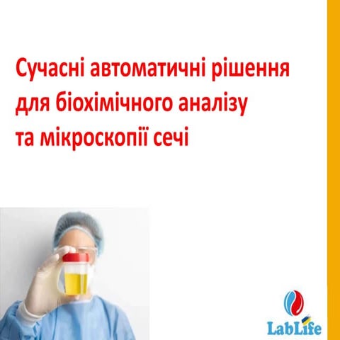 Автоматичний аналіз сечі: мінімум участі - максимум можливостей