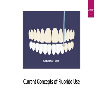 CURRENT CONCEPTS OF FLOURIDE USE | PPTX