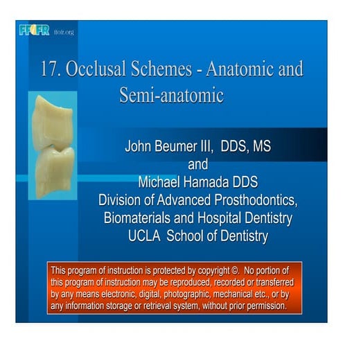 17.occlusal schemes anatomic and semiamatomic occlusion
