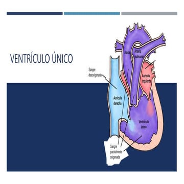 17- Ventrículo único.pptx
