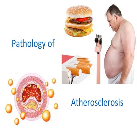 17970_27.1Atherosclerosis.pptx