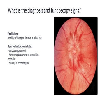 17 short Objective Structured Clinical Examination (OSCE) cases.pptx