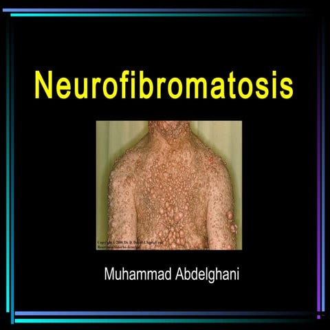 18. neurofibromatosis   muhammad abdelghani