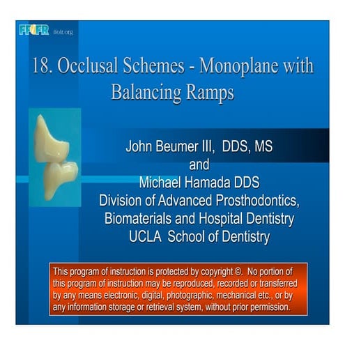 18.occlusal schemes monoplane with balancing ramps