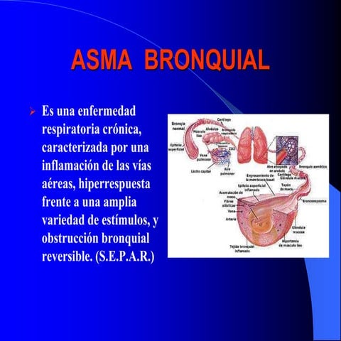 FISIOÁTOLOGIA Y TRATAMIENTO DEL ASMA BRONQUIAL | PPT