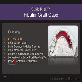 19 fibular graft case