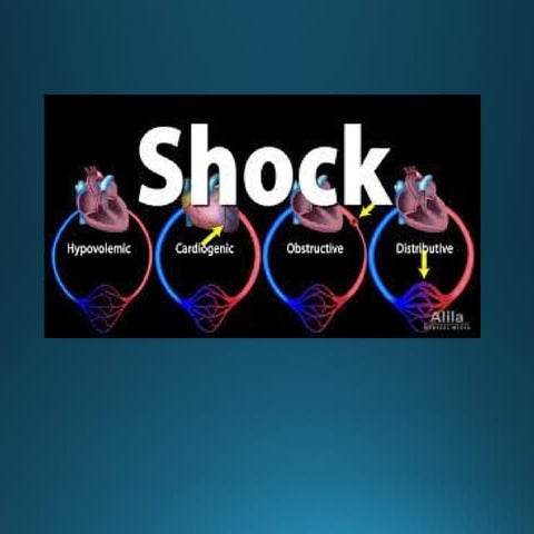 Hyovolemic shock | PPTX