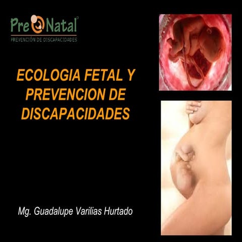 1 ecología fetal y pd