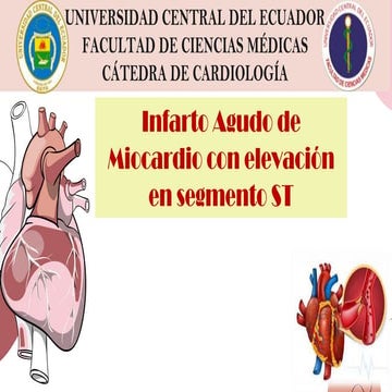 CARDIOLOGÍA, INFARTO AGUDO DE MIOCARDIO CON ELEVACION DEL SEGMENTO ST.pptx