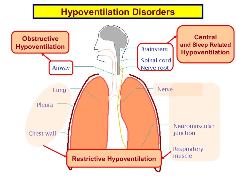 1 hypoventilation disorders
