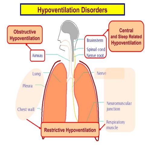 1 hypoventilation disorders