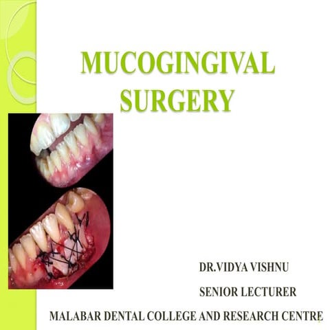 Mucogingival Surgery