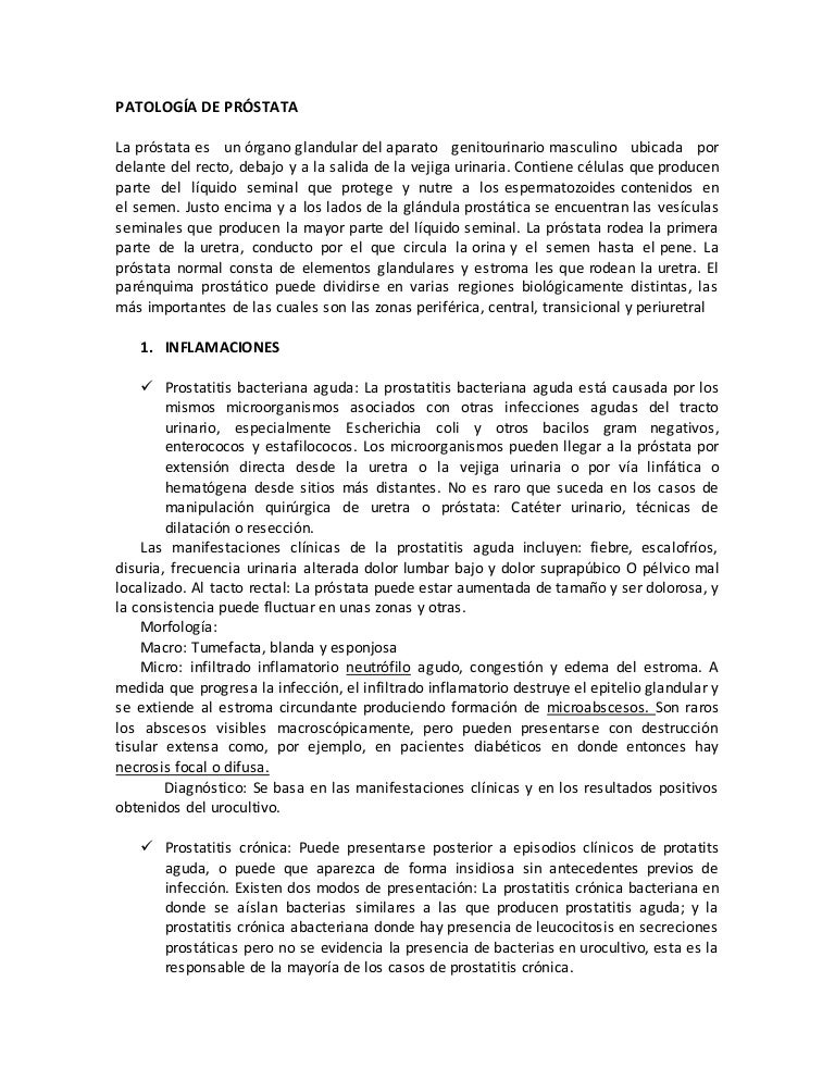 con radiología se destruyen los ganglios linfáticos de la próstata con radiología se destruyen los ganglios linfáticos de la próstata