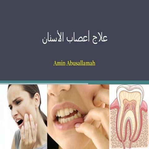 علاج أعصاب الأسنان