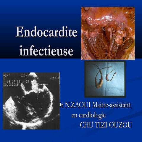 2.endocadite inféctieuse tizi dim 29 09-2013