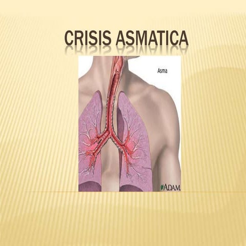 Crisis asmatica