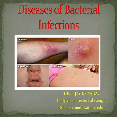 2. Diseases  of bacterial infections