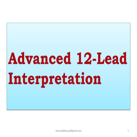 2. advanced 12 lead ecg interpretation by sammy | PPTX