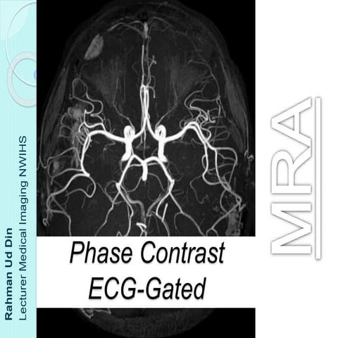Phase Contrast and ECG-Gated MRA 