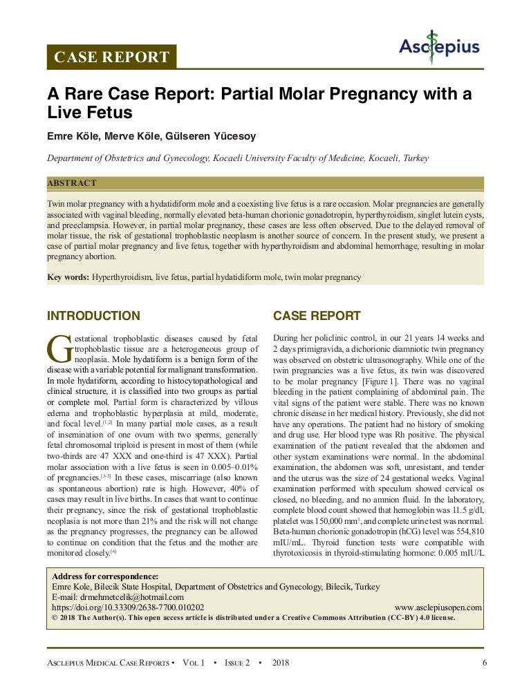 A Rare Case Report: Partial Molar Pregnancy with a Live Fetus