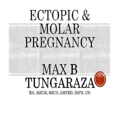 2. ECTOPIC & MOLAR PREGNANCY.pptx