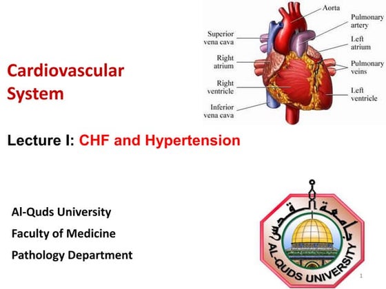 Right and left ventricular hypertrophy | PPT