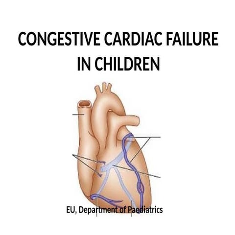 2. CONGESTIVE CARDIAC FAILUREPAEDS (2).pptx
