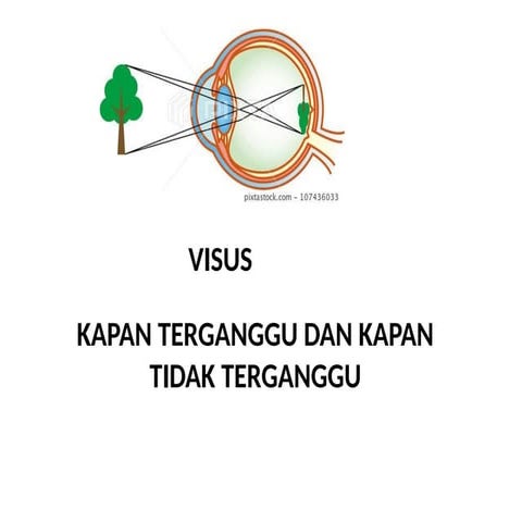 Visus turun mendadak kapan terganggu dan tidak terganggu | PPTX