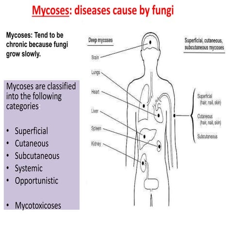 2-Superficial, Cutanous &systemic.ppt