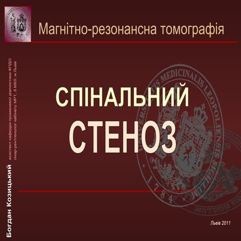 Спинальный стеноз | PPT