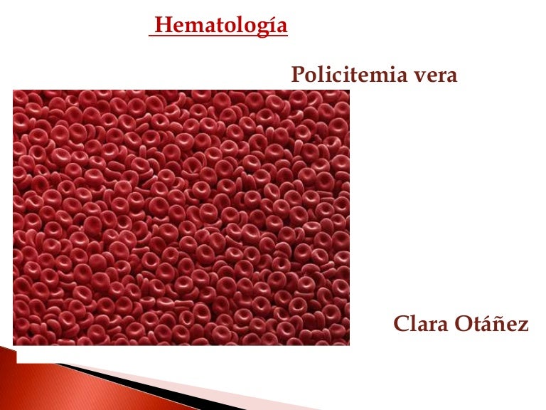 policitemia vera