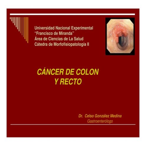 PATOLOGÍAS DE COLON.pptxPATOLOPATOLOGÍAS | PPTX
