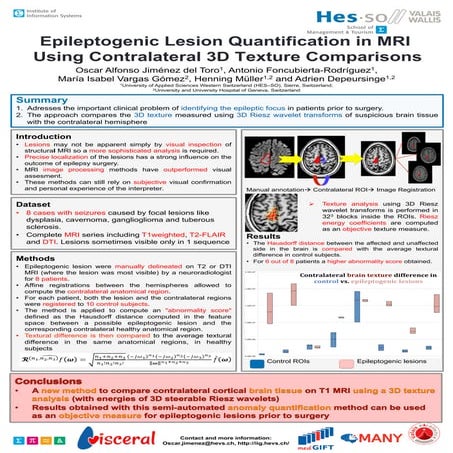 Epileptogenic Lesion Quantification in MRI Using Contralateral 3D Texture Com...
