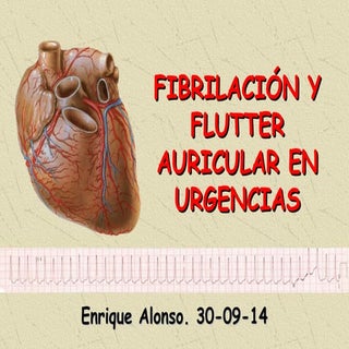 (2014 09-30) FIBRILACION AURICULAR ...
