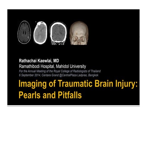 Traumatic Brain Injury Pearls and Pitfalls (2014)