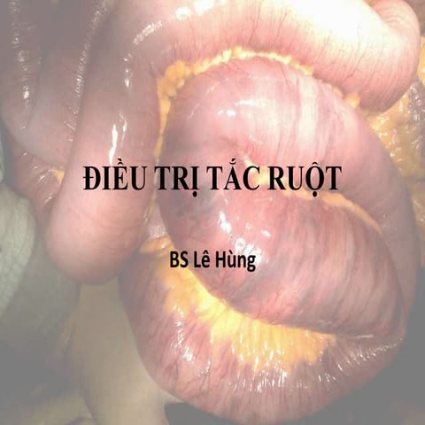 20151012 Điều trị tắc ruột