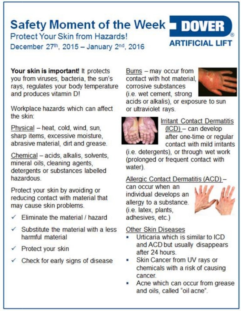 Dover Als Safety Moment Of The Week 27 Dec 15