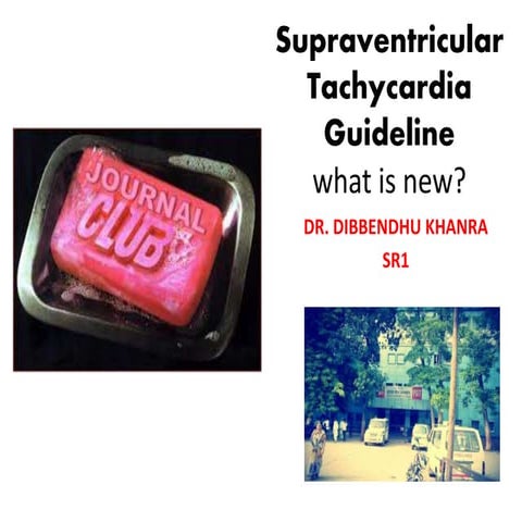 Supraventricular tachycardia: ECG recognition and diagnosis | PPTX