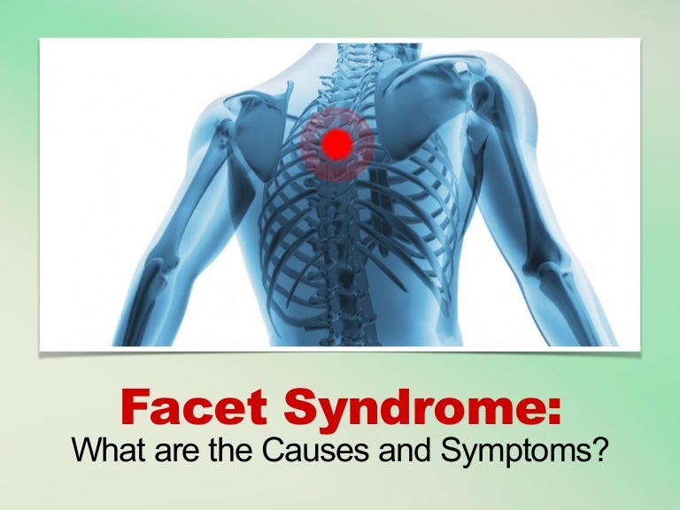 Facet Syndrome Causes and Symptoms