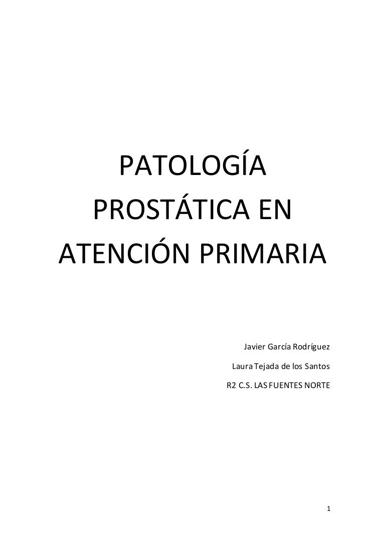 Pautas para la biopsia de próstata en hombres 40-49 sin PSA 25