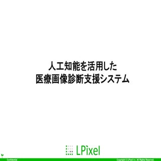 20170428 全脳アーキテクチャmeetup final