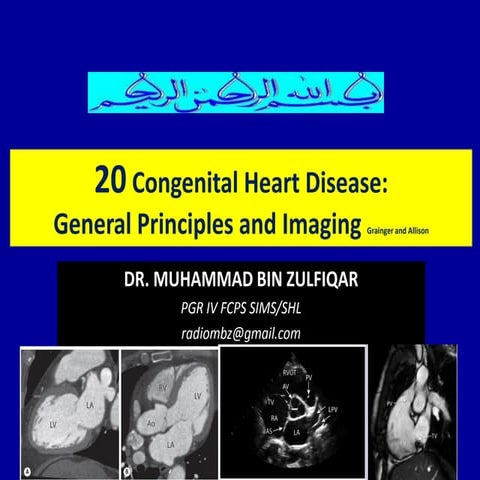 20 congenital heart disease Dr. Muhammmad Bin Zulfiqar