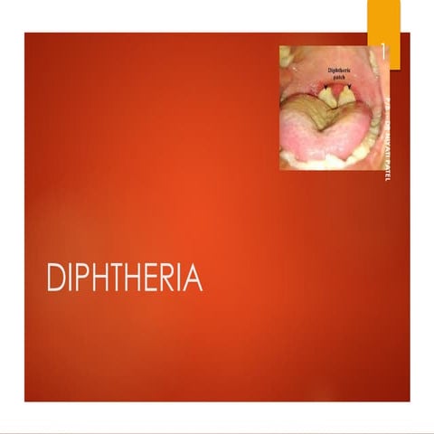 21.DIPTHERIA.pdf
