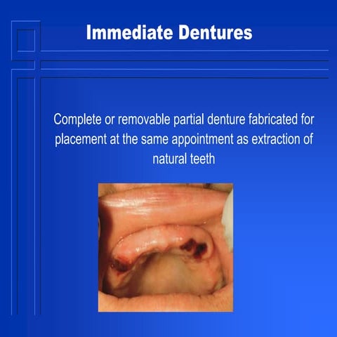 bite registeration.pptx
