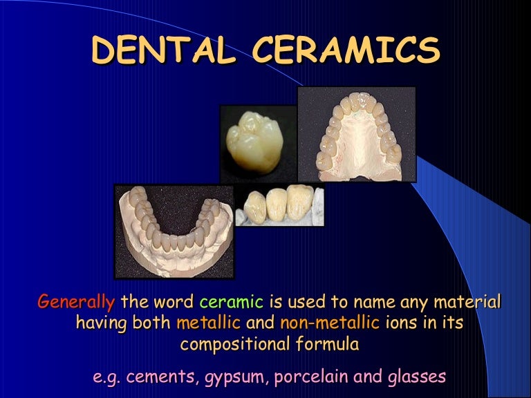 DENTAL CERAMICS Dental Porcelain AllCERAMIC RESTORATIONS dental mate…