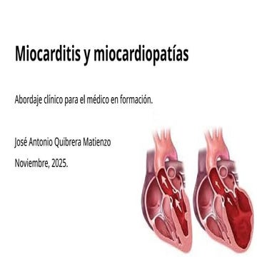 21 Miocarditis y miocardiopatías, enfoque clínico.pptx