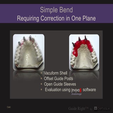 21 simple bend requiring correction in 2 planes