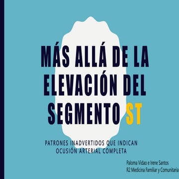 (22-12-22) Más allá de la elevación del segmento ST (PPT).pptx